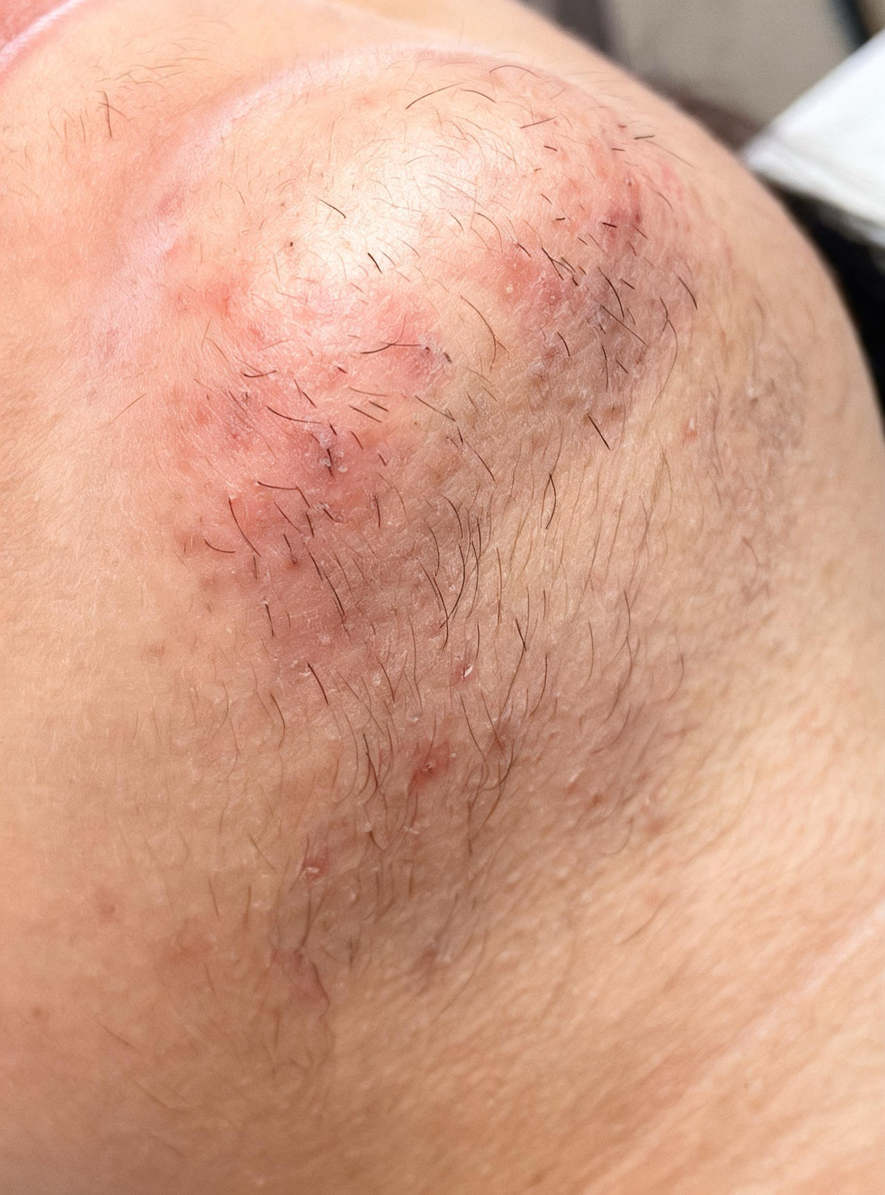 Pourquoi j'ai des poils ? La réponse honnête, à tout âge