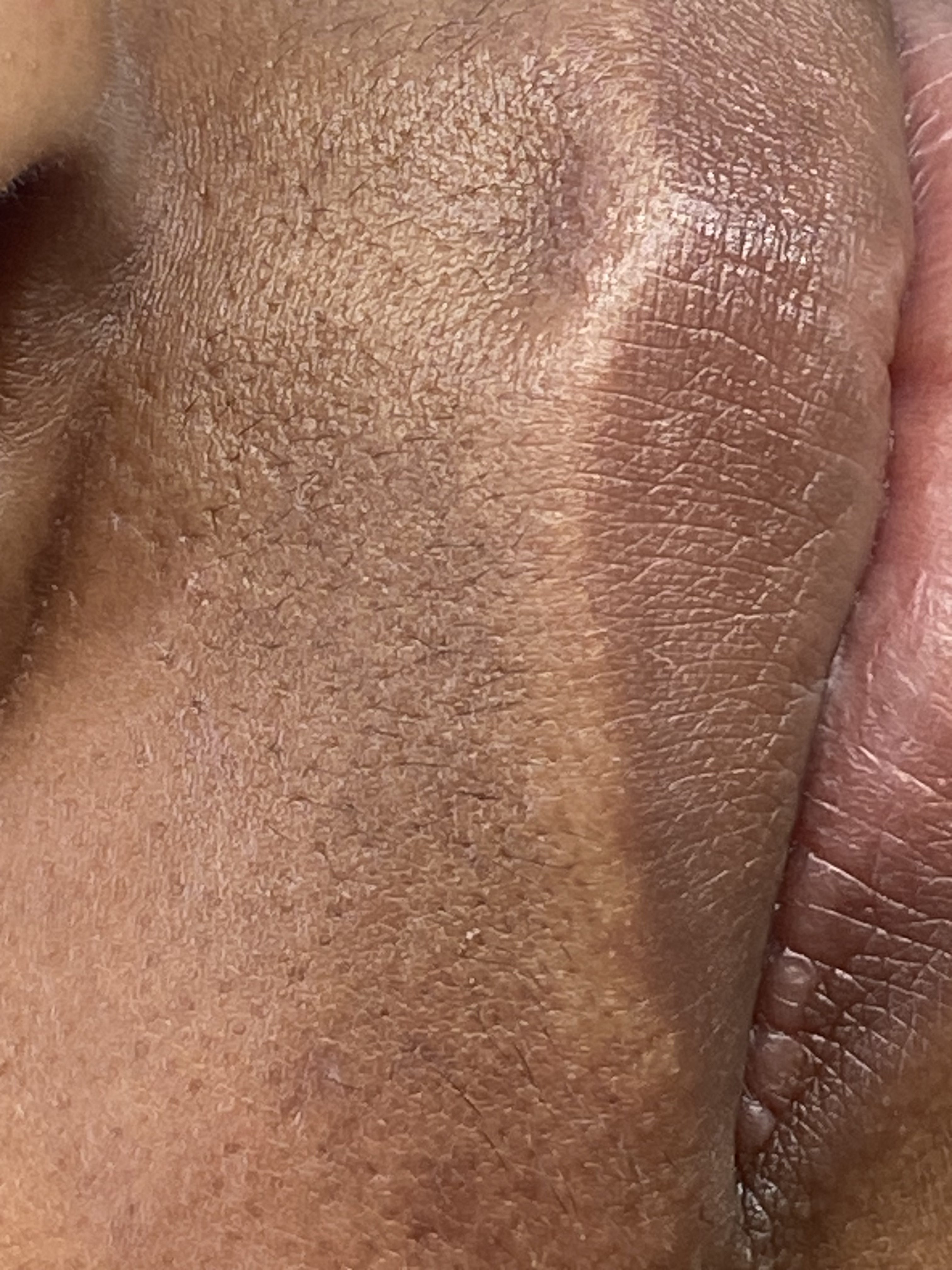Hormones et pilosité : pourquoi les poils s'invitent (vraiment) après 40 ans