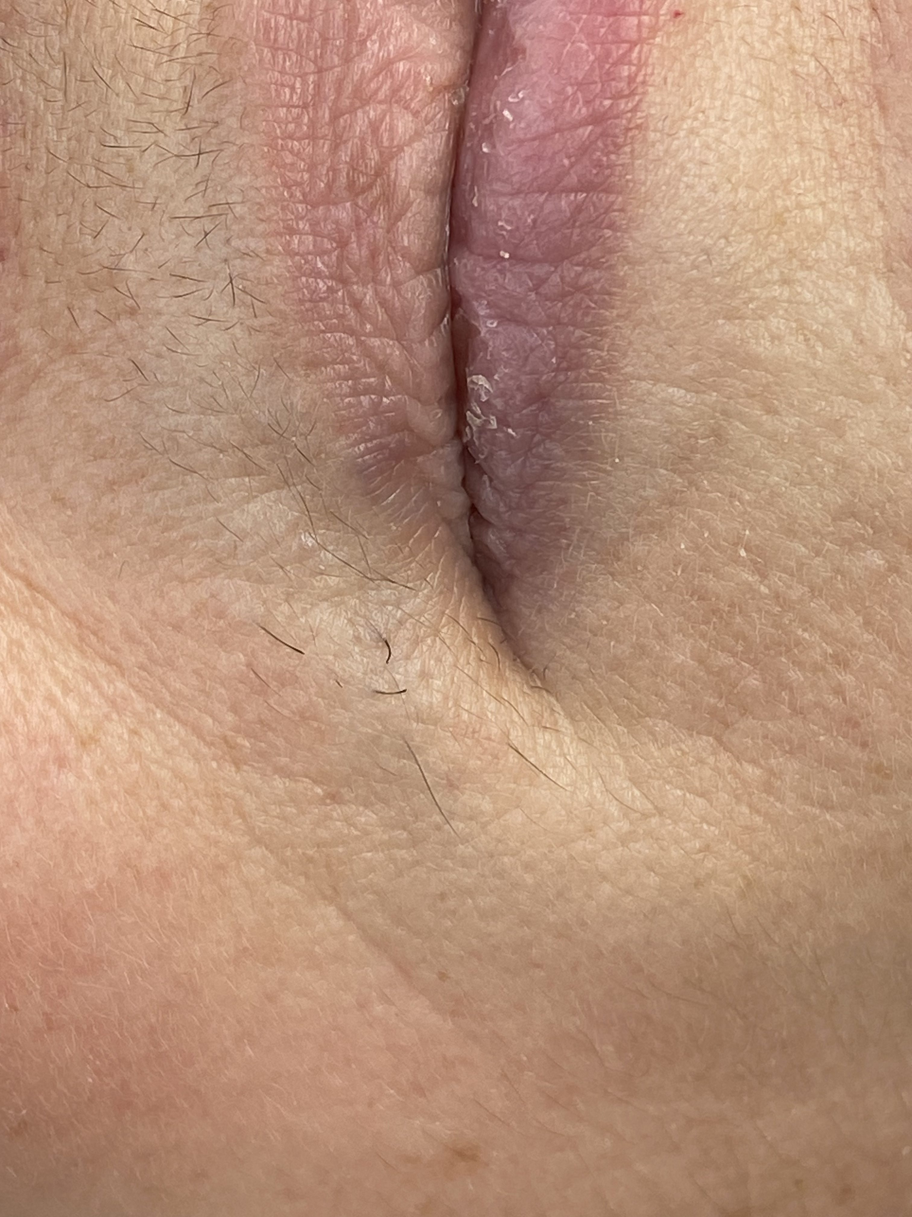 Electrolysis prices in Luxembourg: understanding the real cost